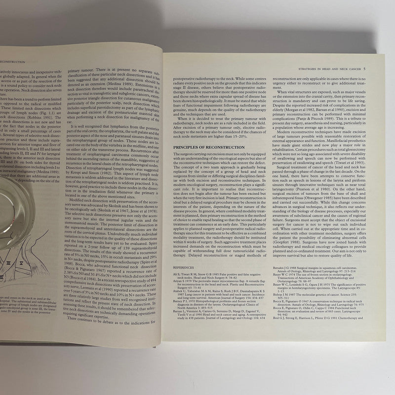 Excision And Reconstruction In Head And Neck Cancer; Soutar, D; Tiwari, R