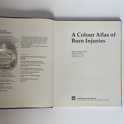 A Colour Atlas Of Burn Injuries; Clarke, John